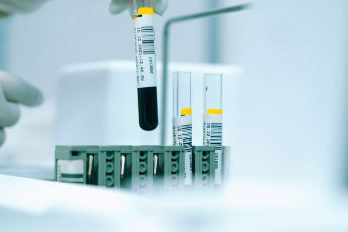 Eli Lilly&colon; &Uuml;bernahme&comma; Ausbau&comma; Rekordkurs