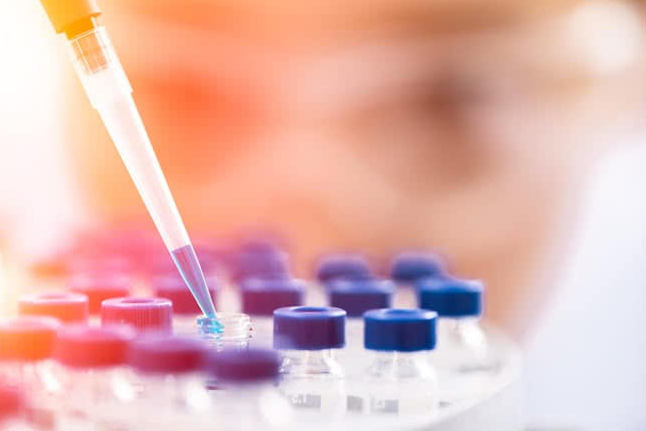 Qiagen: KI-Kooperationen und Digital-PCR wecken Übernahmeinteresse