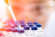 Thermo Fisher Scientific: Strategische Neuausrichtung und Margenwachstum!