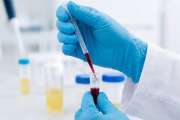 Biotech- und Life-Science-Boom: Evotec, BioNxt Solutions und Merck – wo lohnt sich ein Investment?