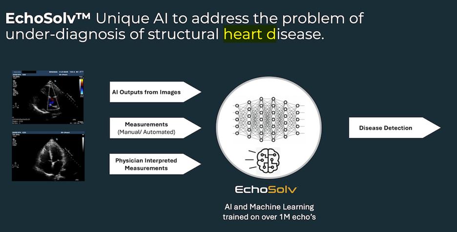 With FDA approval close, Echo IQ's AI platform is set to disrupt US heart disease market - Stockhead